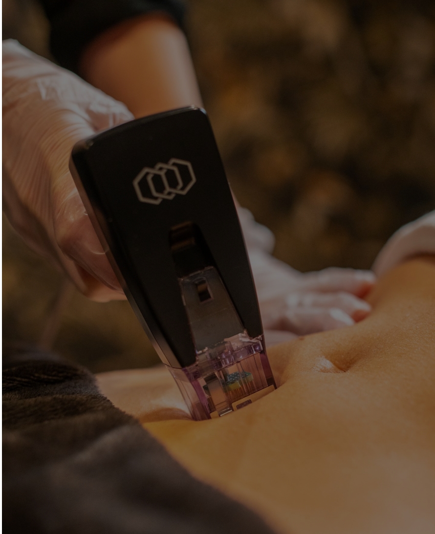 EVO Beauty Clinics recomienda iniciar los tratamientos corporales ahora para lucir cuerpo en verano